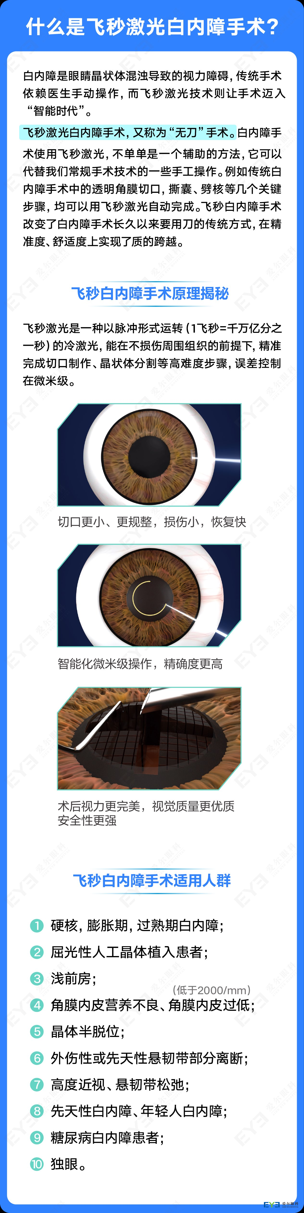 飞秒激光白内障手术