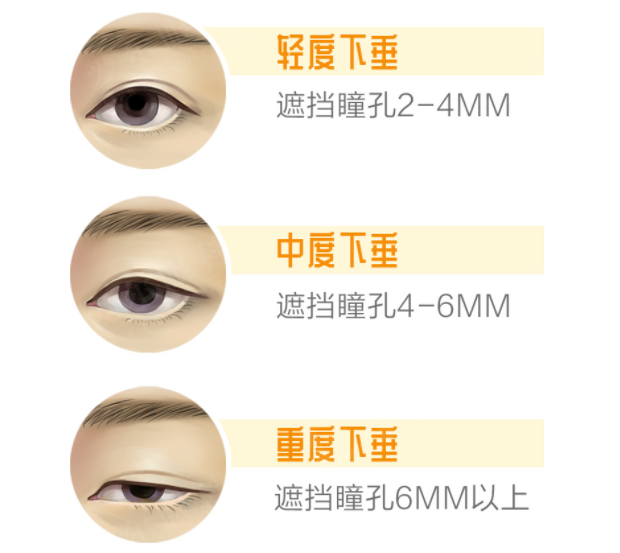 图片1 图片1