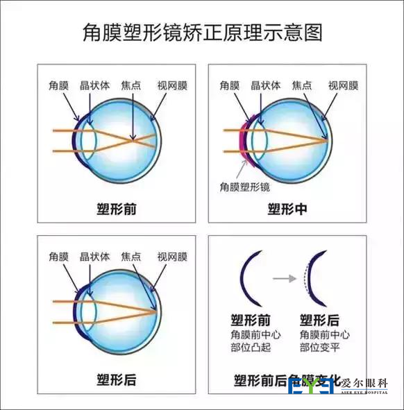 图片1 图片1