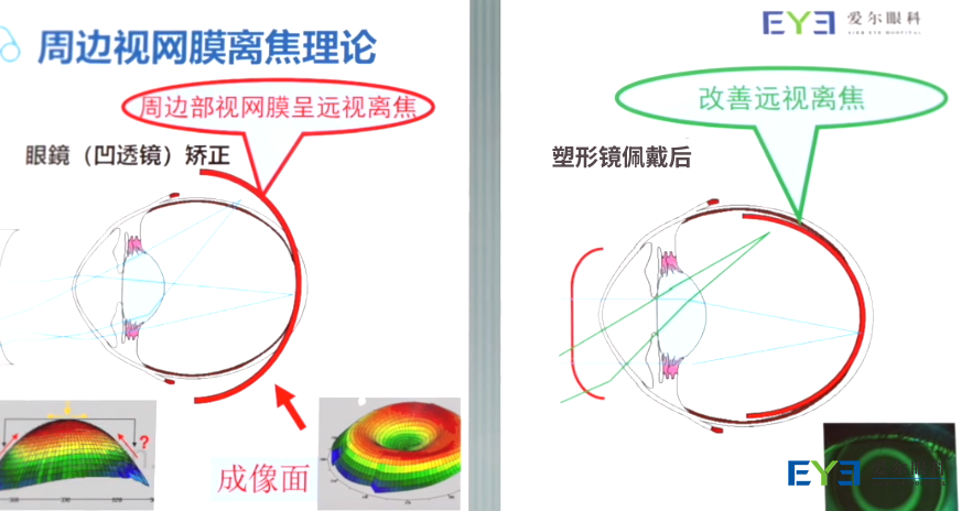 图片 2