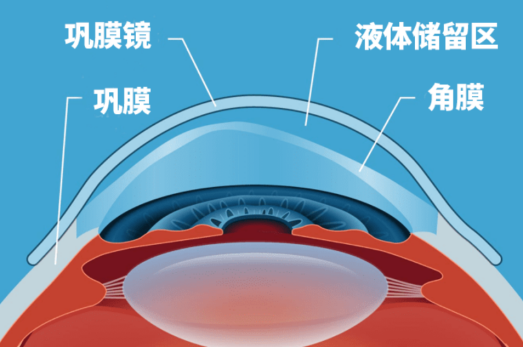 图片 2 图片 2