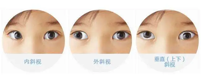 图片 1 图片 1