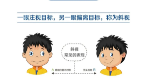 儿童斜视简单自测，只要1分钟！