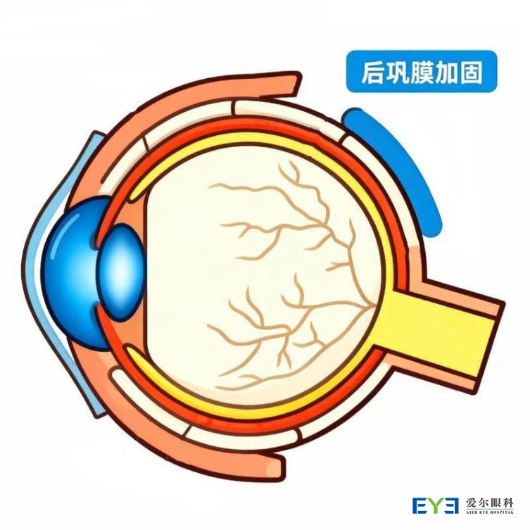 图片 1 图片 1